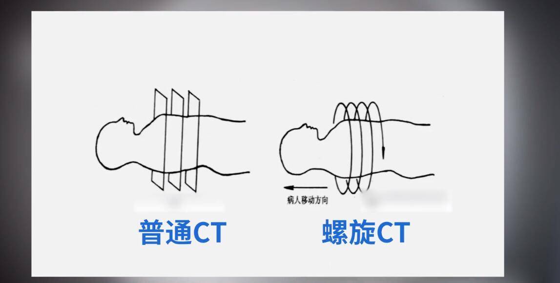 联影医疗获得发明专利授权：“一种医学影像扫描方法、系统、介质以及移动CT扫描设备”