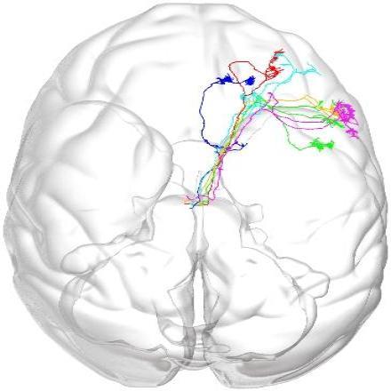 微米级“脑地图”来了！我国科学家在脑图谱研究领域取得新突破