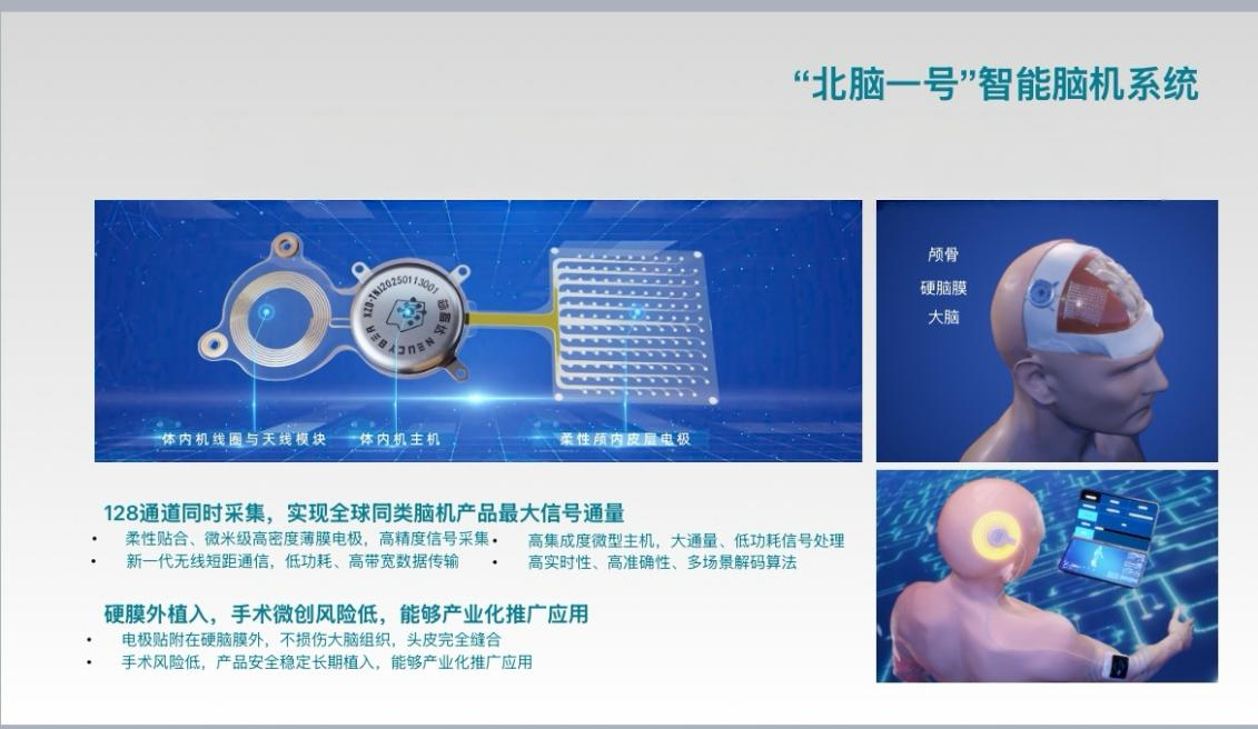 超百通道全侵入式脑机接口进入临床试验